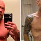 Contaminé, cet infirmier américain a publié une photo pour montrer les ravages du Covid-19 sur son corps meurtri