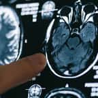 Une radiologie du cerveau