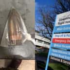 Un homme admis aux urgence avec un… obus anti-char dans le rectum