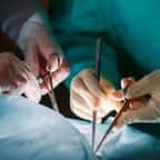 États-Unis : la transplantation d’un rein de porc sur un humain réussie, une grande première