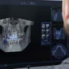 Un dentiste mod&eacute;lise en 3D la m&acirc;choire d'un patient