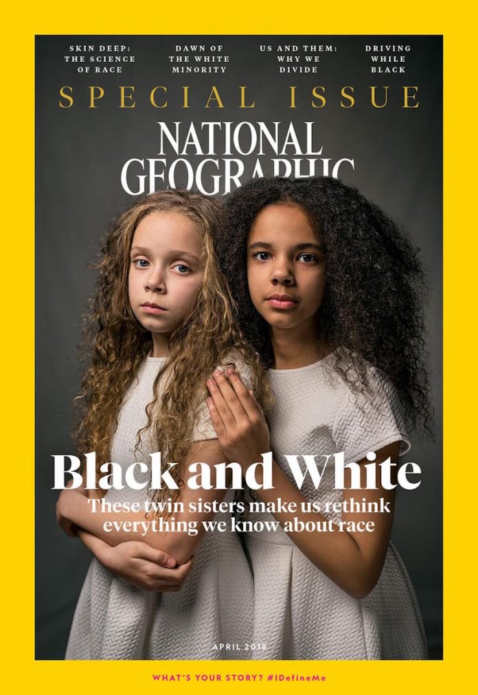 Jumelles, ces deux sœurs n'ayant pas la même couleur de peau brisent les préjugés en couverture de National Geographic National-geographic-soeurs-jumelles-racisme-1-696x1012