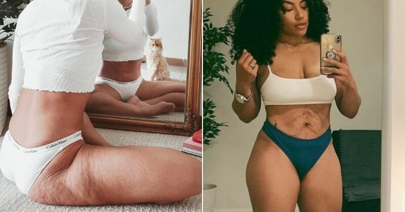 Ces femmes montrent qu'Instagram n'est pas la réalité en partageant des photos non retouchées de leur corps