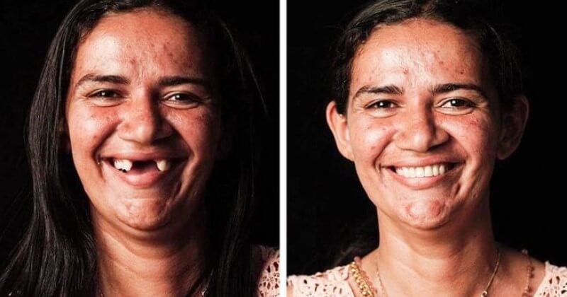 Ce dentiste brésilien voyage à travers le monde pour offrir des soins dentaires aux plus démunis