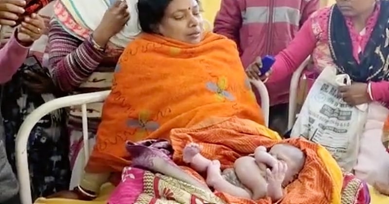 Inde : un bébé né avec 4 bras et 4 jambes célébré pour sa ressemblance avec une déesse hindoue