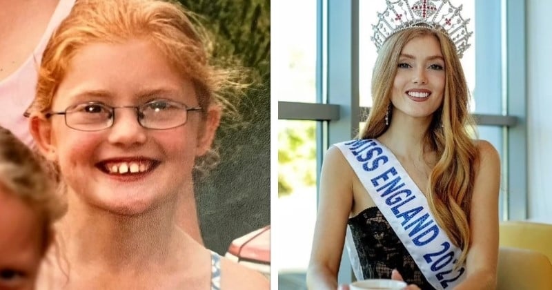 Frappée et brûlée à l'école à cause de ses cheveux roux, elle devient Miss Angleterre et fait de sa différence une force