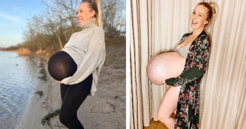 Enceinte de triplés, elle partage des photos de son ventre à la forme inhabituelle