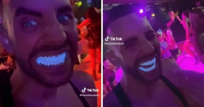 Il découvre que ses dents sont fluorescentes après les avoir fait refaire en Turquie