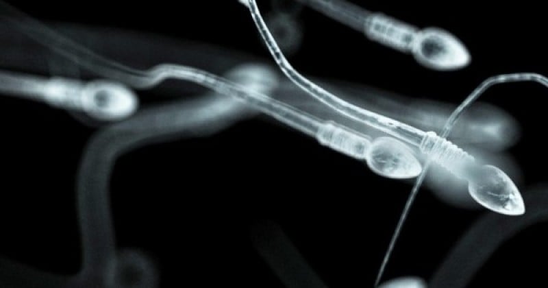 La baisse de la fertilité et de la qualité du sperme « pourraient bien signer l'extinction de masse de l'espèce humaine », selon une équipe de chercheurs