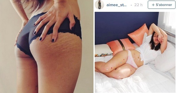 Oui, la cellulite et les vergetures, c'est NORMAL ! Cette nouvelle tendance sur le web est en train de décomplexer enfin toutes les femmes...