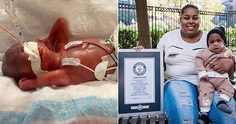 Né à seulement 21 semaines de grossesse, ce bébé américain est devenu le plus prématuré du monde à survivre