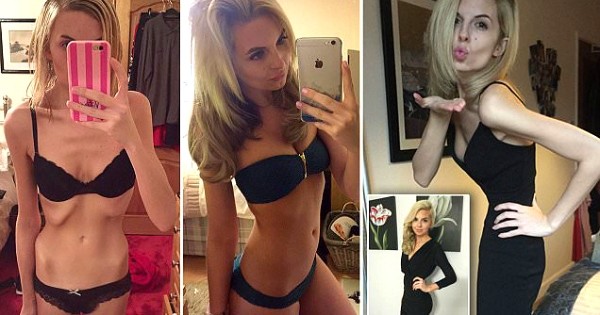 Elle pesait 38 kilos à 23 ans... Découvrez comment partager son histoire sur Instagram lui a permis de gagner son combat contre l'anorexie