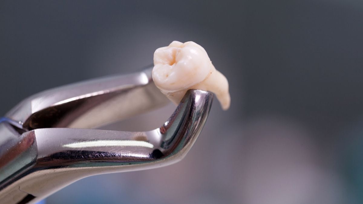 Elle découvre une... dent humaine dans un plat préparé par un traiteur 