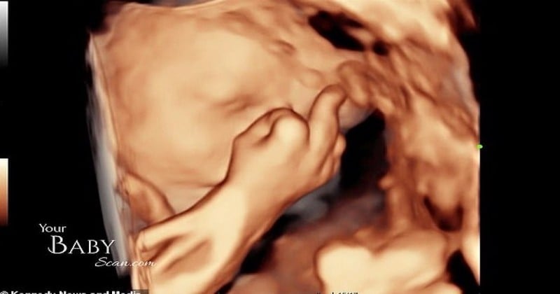 Ce futur bébé fait un doigt d'honneur à ses parents lors d'une échographie en 4D