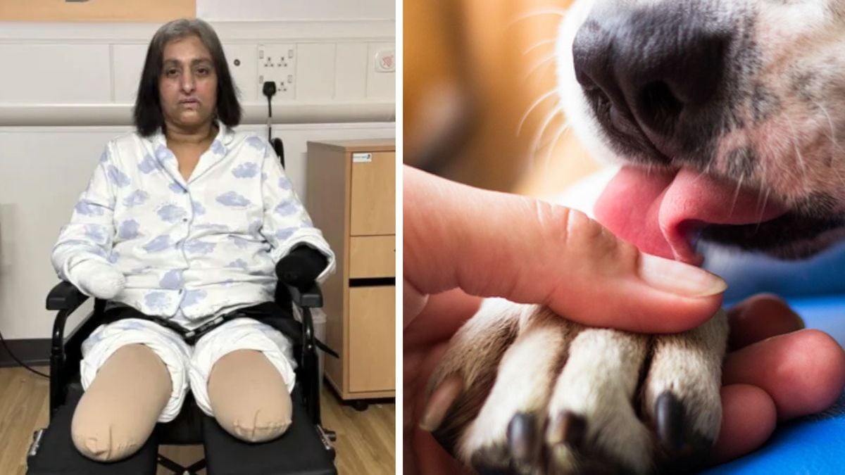 Manjit Sangha amputée des quatre membres