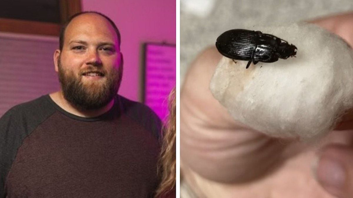 Il débarque à l'hôpital en se tordant de douleur, les médecins découvrent une créature énorme dans son oreille