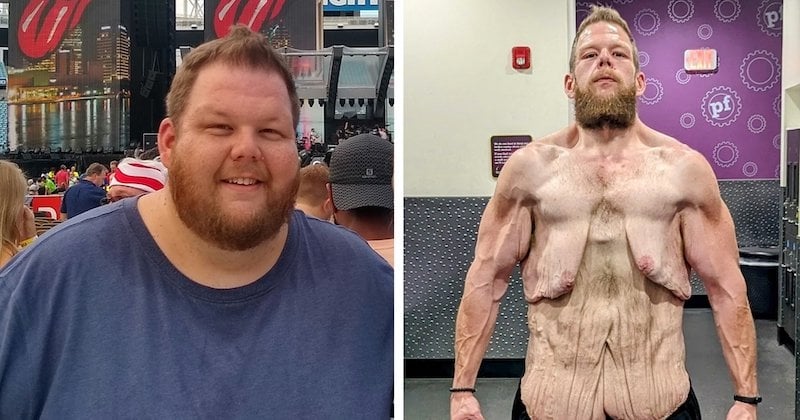 Après avoir perdu 150 kilos, il montre son incroyable transformation