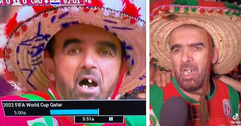 Coupe du monde : ce supporter est moqué pour ses dents, un dentiste lui apporte son aide et le résultat est impressionnant