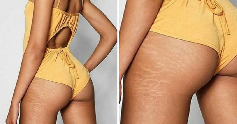 Après d'autres enseignes, c'est au tour de Boohoo de ne plus retoucher les vergetures et autres marques naturelles de ses mannequins  