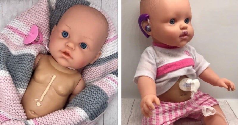 Cette mère de famille crée des jouets pour les enfants handicapés, en modifiant des poupées à leur image	