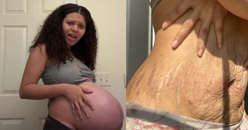 Cette maman brise les clichés de la grossesse en affichant son corps post-partum et inspire des millions de femmes