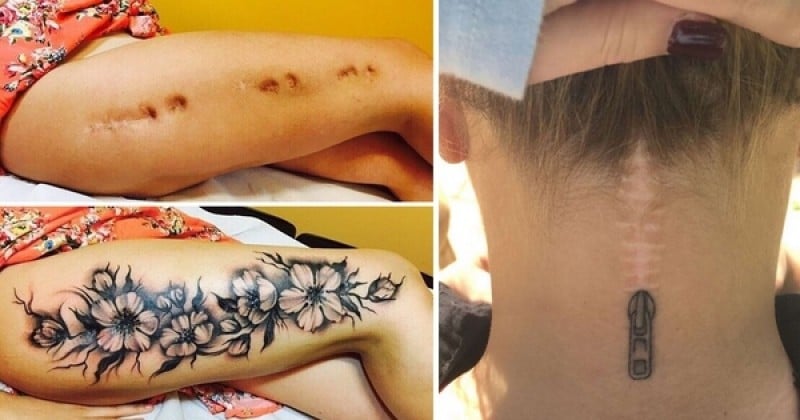 Des artistes tatoueurs transforment les cicatrices pour les rendre plus jolies