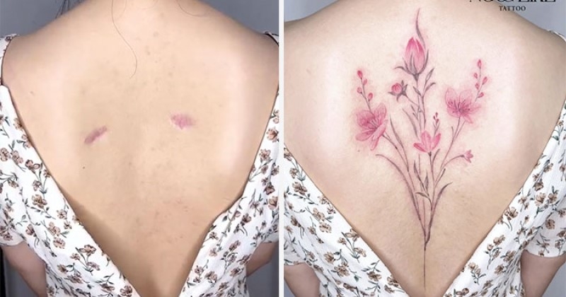 Elle recouvre les cicatrices, imperfections et brûlures des femmes avec de sublimes tatouages