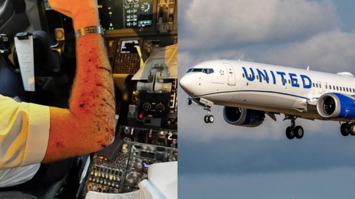 Un objet non identifié heurte le cockpit d'un avion de ligne à 10 000 m d'altitude, le pilote blessé
