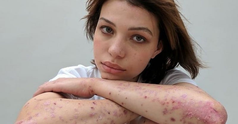 Des femmes révèlent leurs cicatrices dans un puissant projet photographique