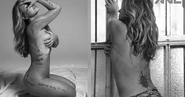 La chanteuse à succès Anastacia livre un témoignage poignant sur ses cancers du sein et sa double mastectomie, au travers de magnifiques photos qui dévoilent ses cicatrices