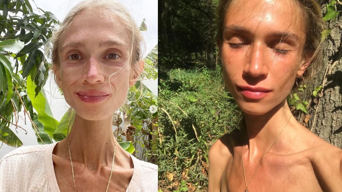 Une femme vegan de 27 ans est morte d'épuisement après avoir adopté un régime extrême, elle ne pesait que 23 kilos