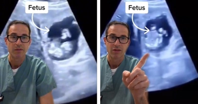 Cette vidéo impressionnante montre un bébé se développant... dans le foie de sa mère