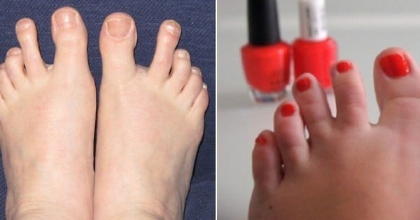 14 pieds qui vont vous faire sortir les vôtres de leur cachette ! N'ayez plus honte, enfin ! 