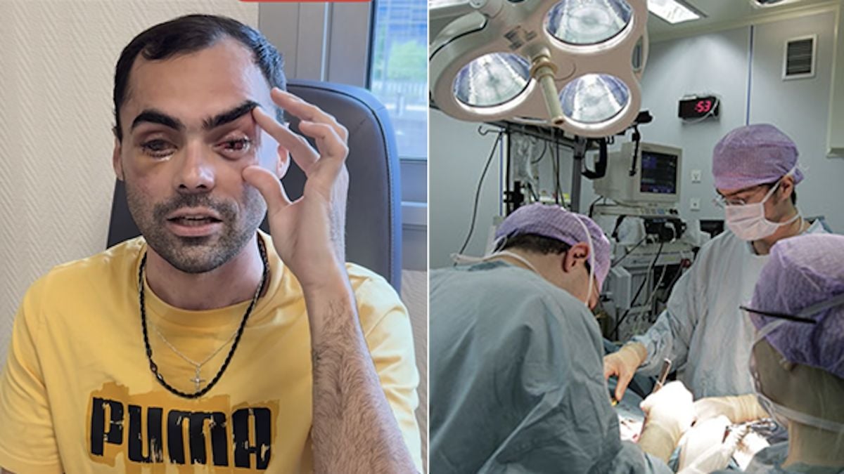 Un aveugle retrouve la vue en se faisant greffer... une dent dans l'oeil