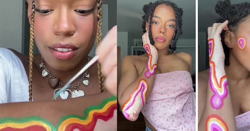 Cette femme fait de son vitiligo un art et se peint le corps 