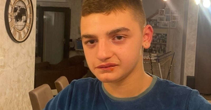 « Ma maladie n'est pas contagieuse » : un jeune autiste se fait exclure d'un bar sous prétexte qu'il « gênait les clients »