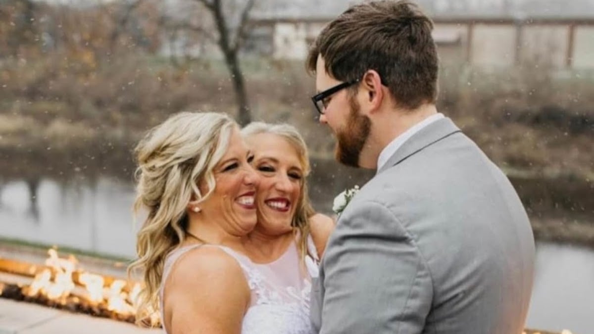 Une jumelle siamoise de 34 ans, ancienne vedette de télé-réalité, s'est mariée sous les yeux de sa soeur