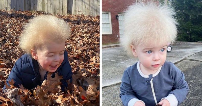 Une mère découvre que son fils est atteint du syndrome des cheveux incoiffables, une maladie rare et méconnue