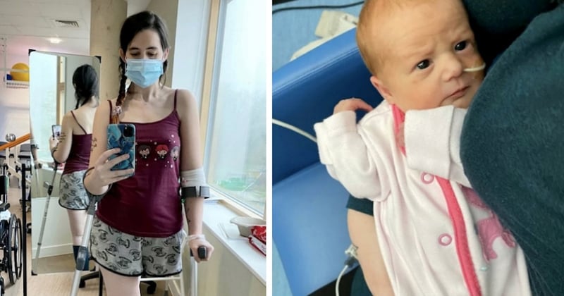 Enceinte et atteinte d'un cancer des os, elle se fait amputer la jambe pour que son enfant puisse naître