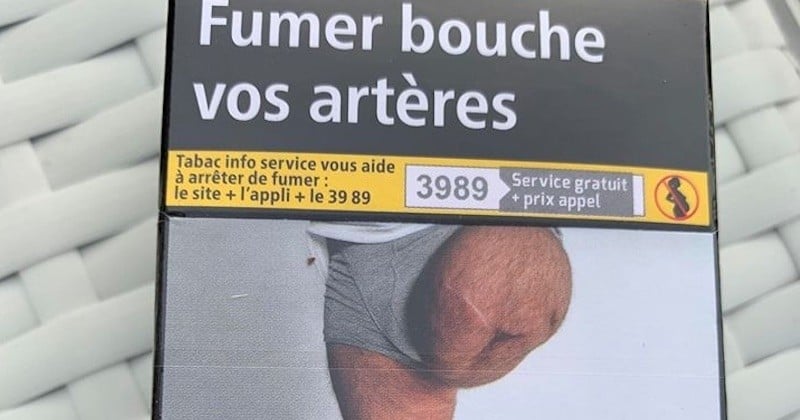 	Ce sexagénaire reconnaît une photo de sa jambe amputée sur un paquet de cigarettes, alors qu'il n'a jamais donné son accord