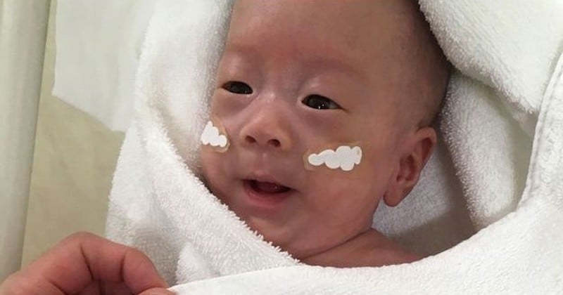 Le plus petit bébé du monde, qui pesait 268 grammes à la naissance, a quitté l'hôpital en bonne santé après 5 mois de soins	
