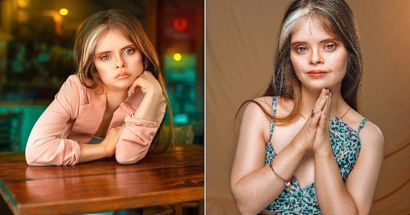Malgré la trisomie 21, cette jeune femme de 22 ans a réalisé son rêve de devenir mannequin