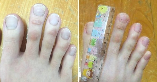 Franchement, avez-vous déjà vu des doigts de pieds comme ça ?