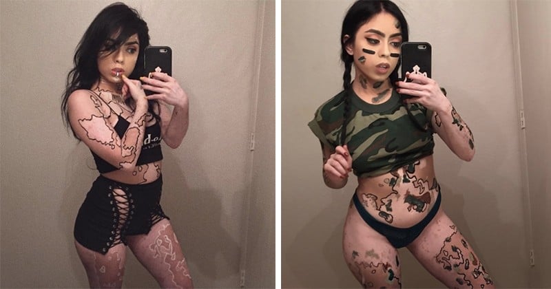 Cette jeune femme atteinte de vitiligo transforme son corps en oeuvre d'art !