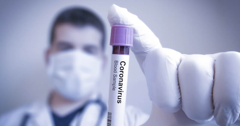 Un laboratoire britannique offre 4000 euros pour inoculer le coronavirus à des patients pour trouver un vaccin