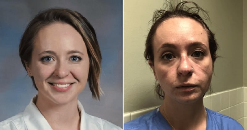 Cette infirmière partage des photos d'elle prises avant et après avoir travaillé huit mois dans un service de Covid-19