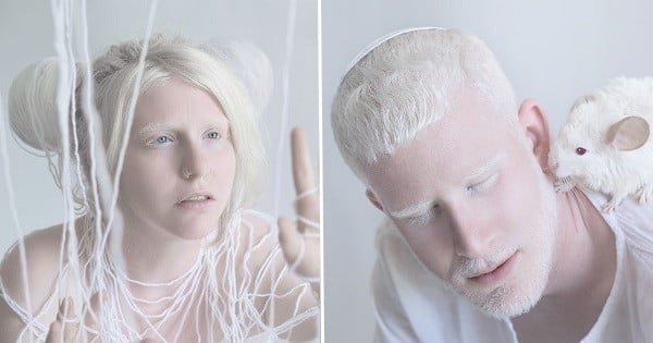 Cette série de photos met en lumière la beauté hypnotisante des albinos