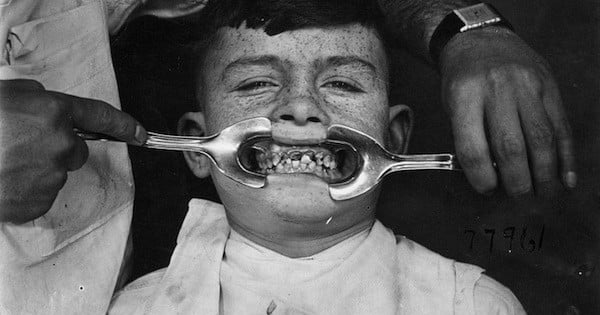 8 instruments de médecine du passé qui nous rappellent pourquoi on a tous peur d'aller chez le dentiste