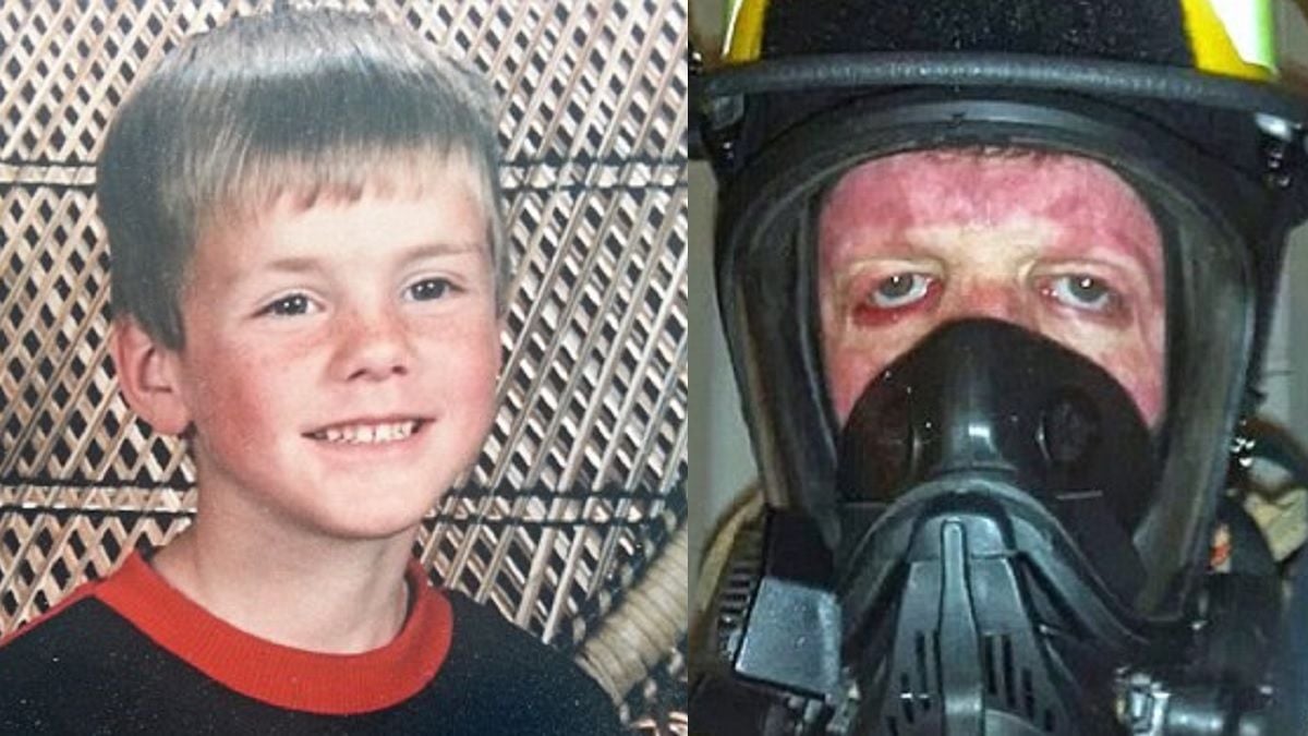 Brûlé à 70% à 6 ans, ce petit garçon terrifié par le feu brave sa peur pour devenir pompier