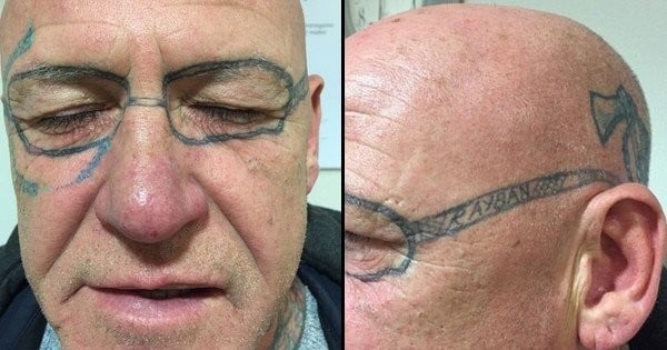 Il se réveille avec des lunettes Ray Ban tatouées sur le visage après un enterrement de vie de garçon un peu trop alcoolisé !
